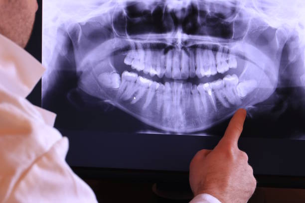 Best Emergency Wisdom Teeth Removal in Weigelstown, PA
